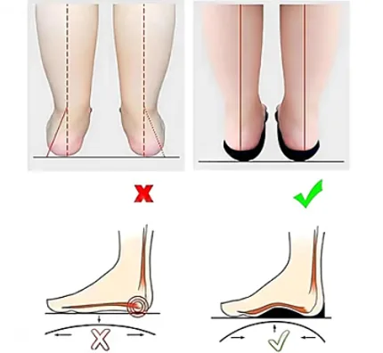 Ortopedik Ayakkabı Tabanlığı Düz Taban Yüksek Kemer ve Ayak D85X